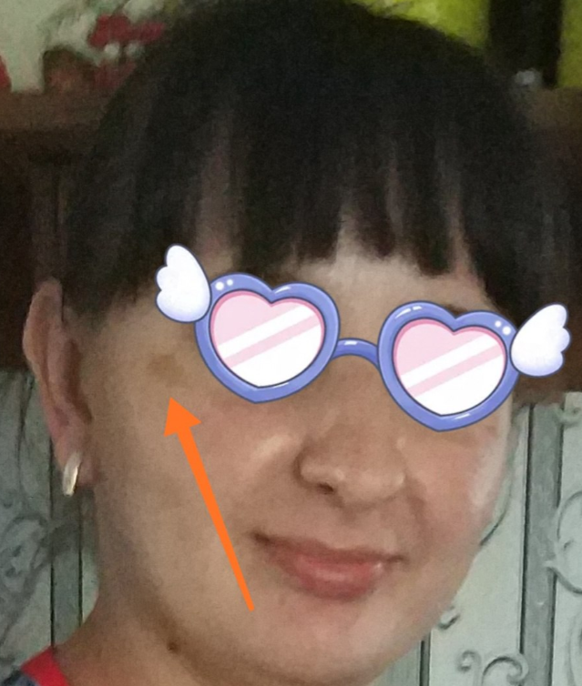 Холодний коректор пігментації